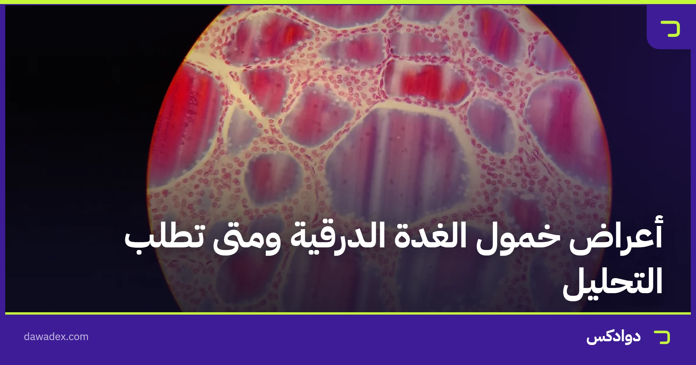 أعراض خمول الغدة الدرقية ومتى تطلب التحليل
