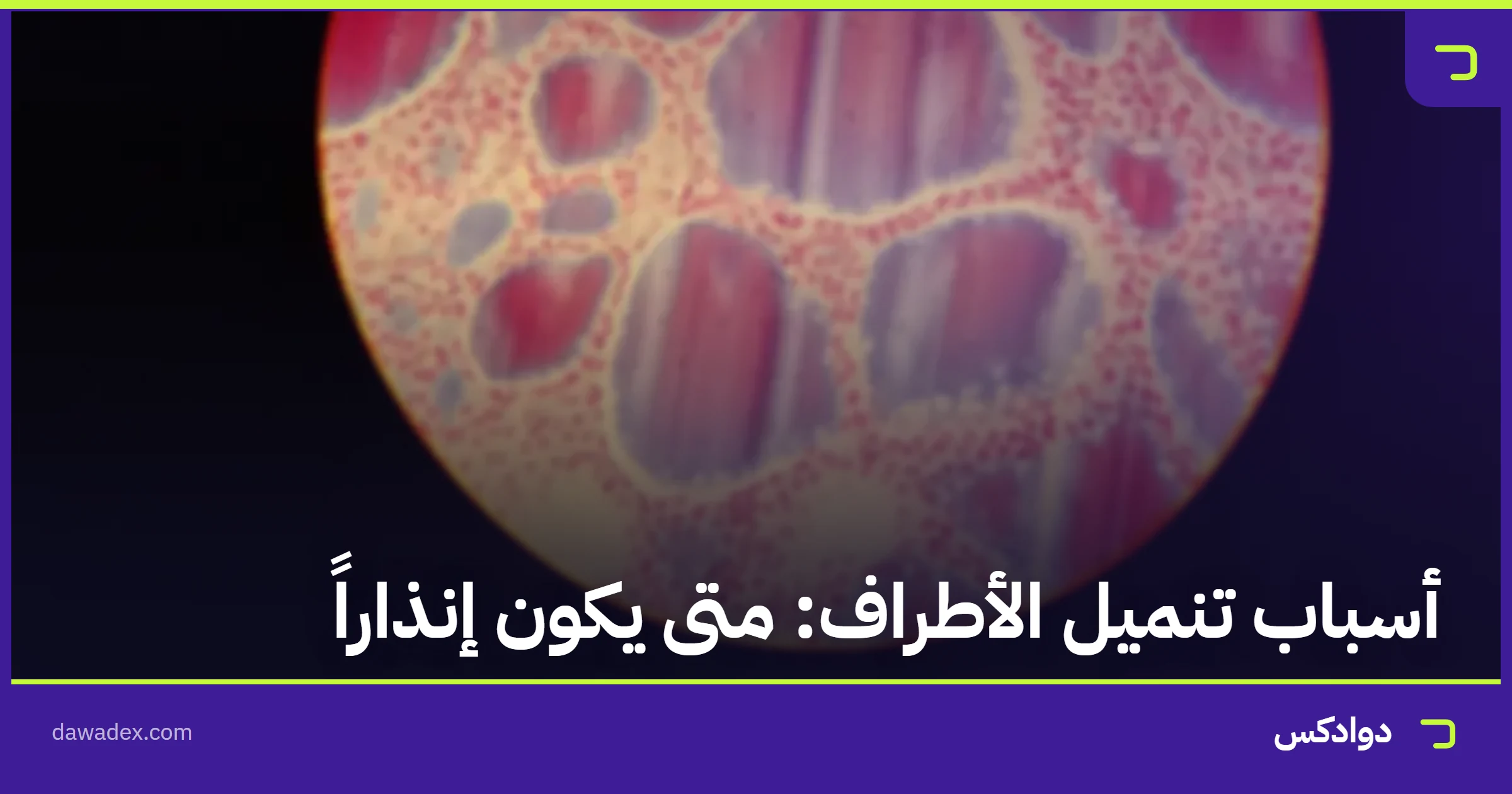 أسباب تنميل الأطراف: متى يكون إنذاراً