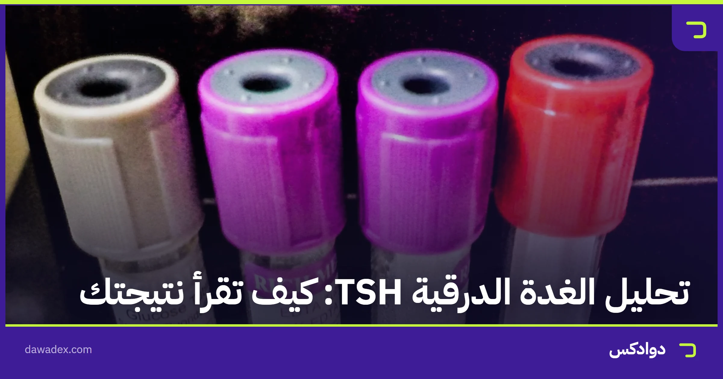تحليل الغدة الدرقية TSH: كيف تقرأ نتيجتك